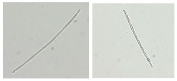 경기도 보건환경연구원에서 국내 수계에서 분리, 실체를 발견한 실린드로스퍼몹시스 광학현미경 사진.